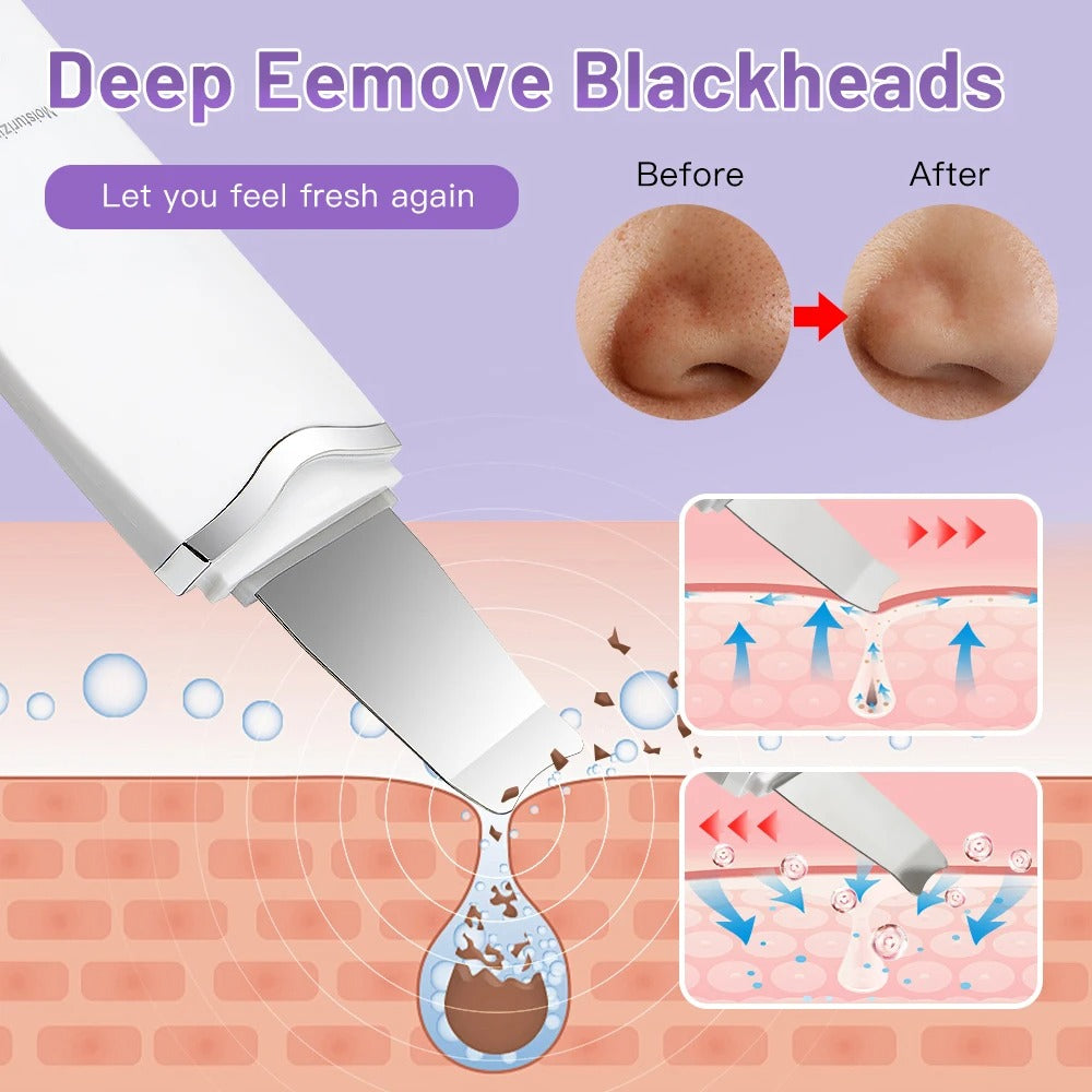 Limpieza facial y exfoliación - Espátula Anti-acné